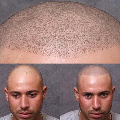 scalp-tattoo.jpg
